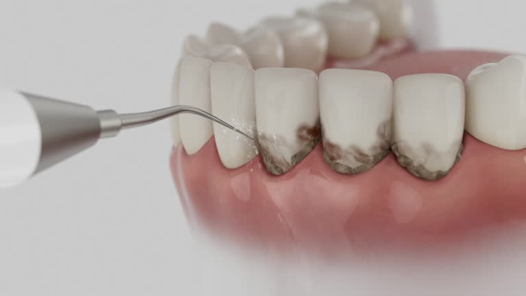 Reliable Dental Implants contractor in Monroe, OH by Smile Center Dentistry